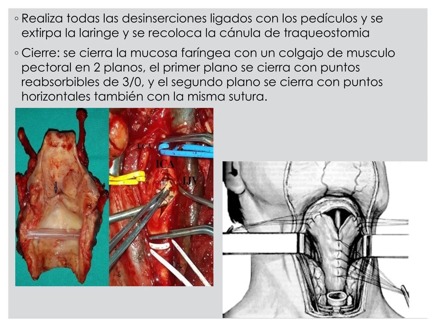 # CIRUGIA DE CABEZA-CUELLO
Y
MAXILOFACIAL • ¿Qué es la cirugía de cabeza y cuello? Como su
nombre lo indica, el servicio médico de Cirugía
