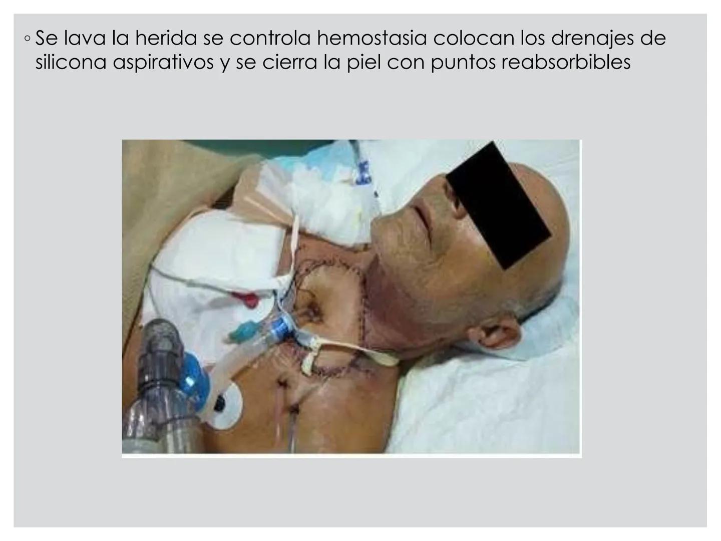 # CIRUGIA DE CABEZA-CUELLO
Y
MAXILOFACIAL • ¿Qué es la cirugía de cabeza y cuello? Como su
nombre lo indica, el servicio médico de Cirugía