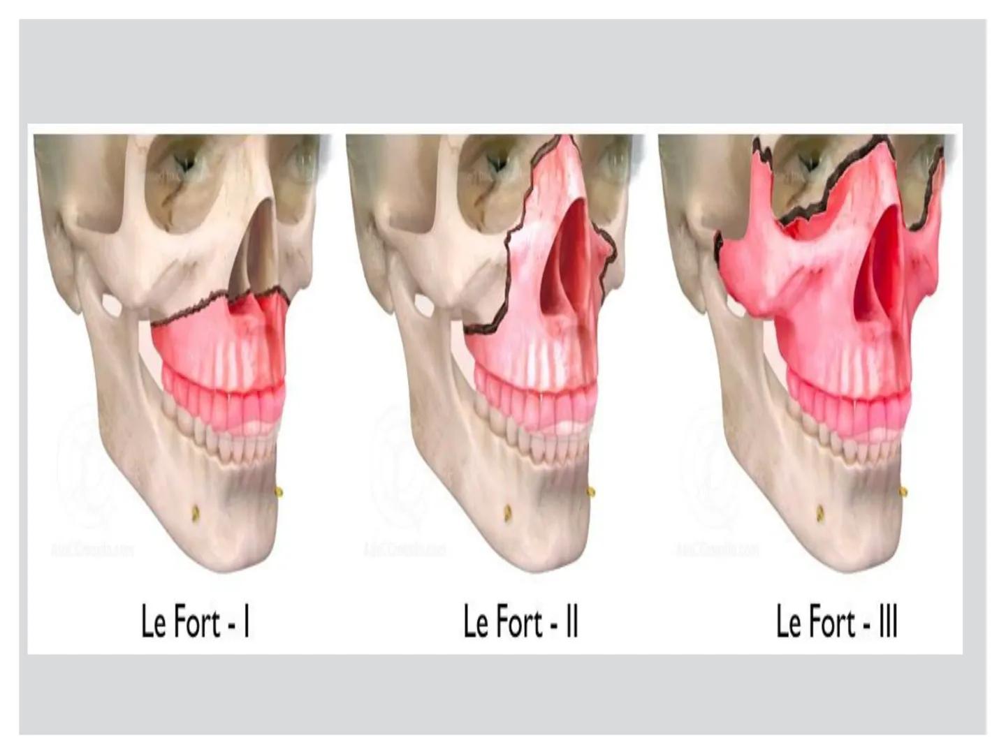 # CIRUGIA DE CABEZA-CUELLO
Y
MAXILOFACIAL • ¿Qué es la cirugía de cabeza y cuello? Como su
nombre lo indica, el servicio médico de Cirugía