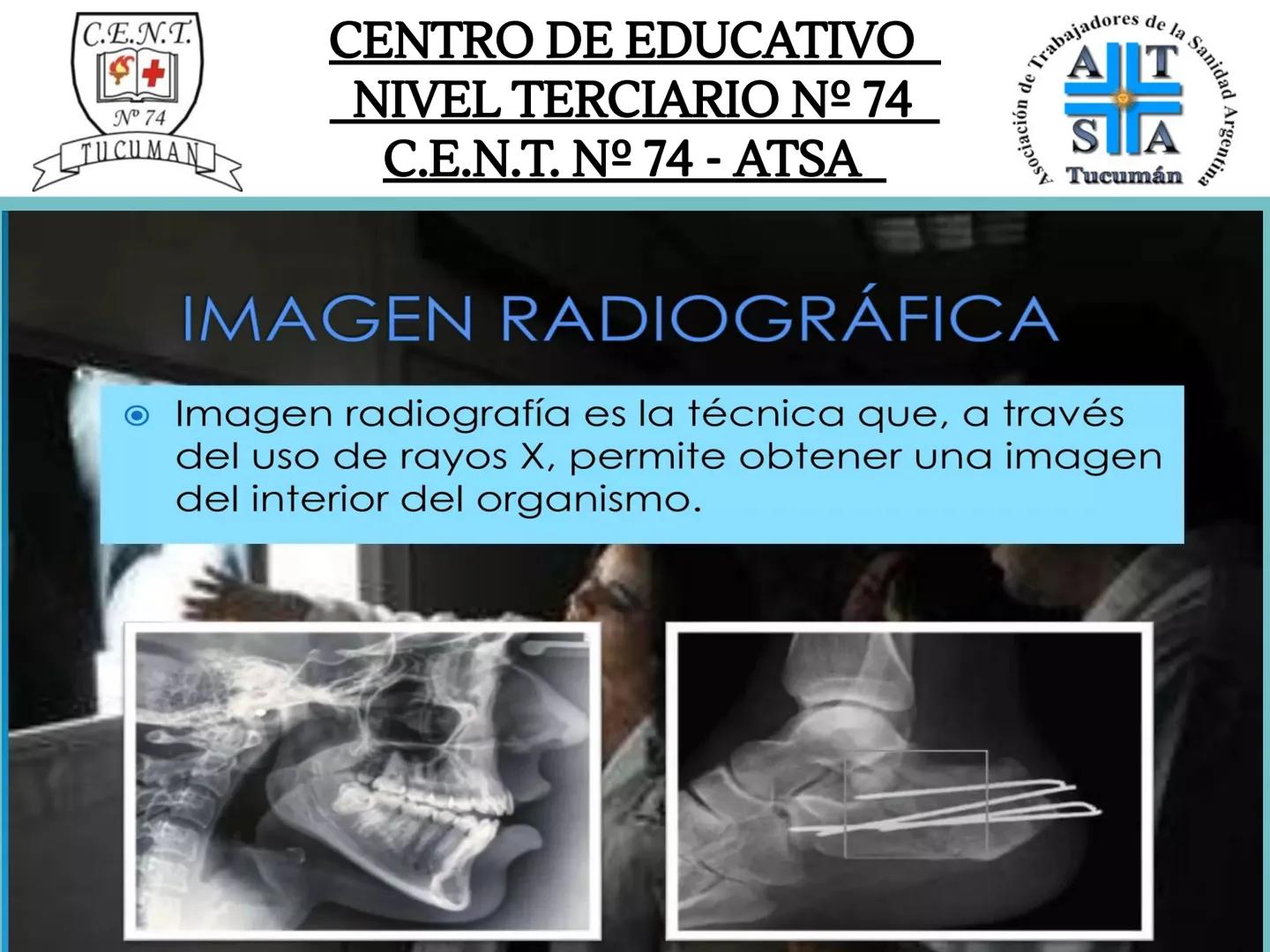 C.E.N.T.
+
N° 74
TUCUMAN
CENTRO DE EDUCATIVO
NIVEL TERCIARIO N№ 74
C.E.N.T. Nº 74 - ATSA
IMAGEN RADIOGRÁFICA
* Imagen radiografía es la