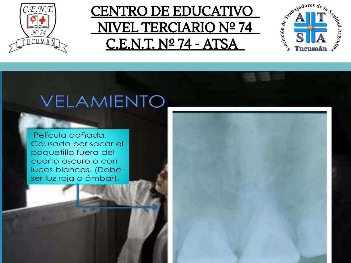 C.E.N.T.
+
N° 74
TUCUMAN
CENTRO DE EDUCATIVO
NIVEL TERCIARIO N№ 74
C.E.N.T. Nº 74 - ATSA
IMAGEN RADIOGRÁFICA
* Imagen radiografía es la