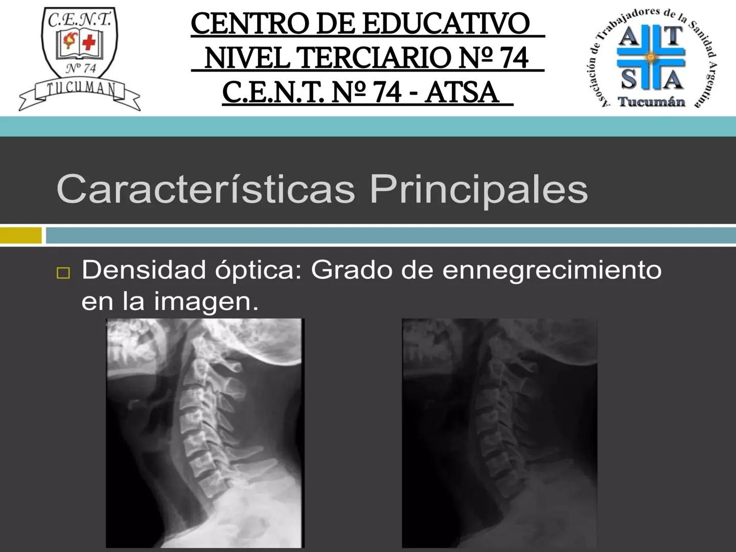 C.E.N.T.
+
N° 74
TUCUMAN
CENTRO DE EDUCATIVO
NIVEL TERCIARIO N№ 74
C.E.N.T. Nº 74 - ATSA
IMAGEN RADIOGRÁFICA
* Imagen radiografía es la