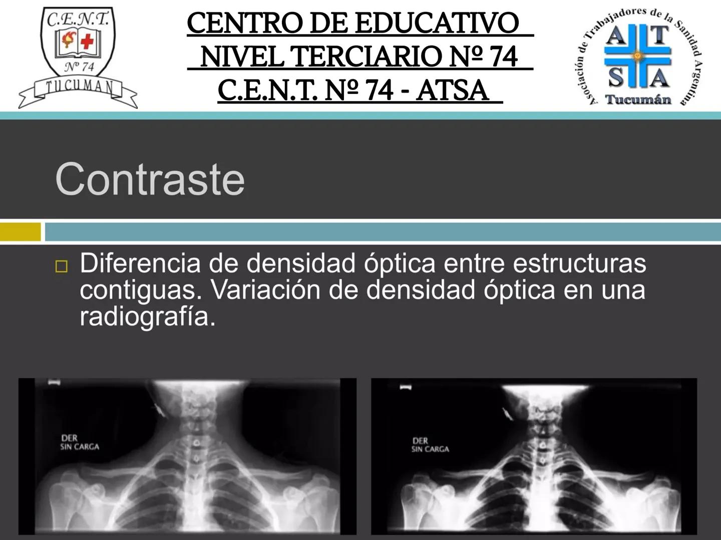 C.E.N.T.
+
N° 74
TUCUMAN
CENTRO DE EDUCATIVO
NIVEL TERCIARIO N№ 74
C.E.N.T. Nº 74 - ATSA
IMAGEN RADIOGRÁFICA
* Imagen radiografía es la