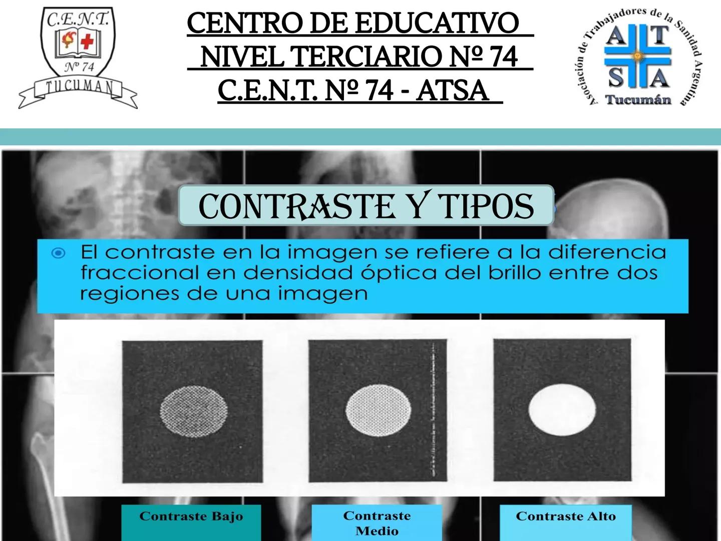 C.E.N.T.
+
N° 74
TUCUMAN
CENTRO DE EDUCATIVO
NIVEL TERCIARIO N№ 74
C.E.N.T. Nº 74 - ATSA
IMAGEN RADIOGRÁFICA
* Imagen radiografía es la