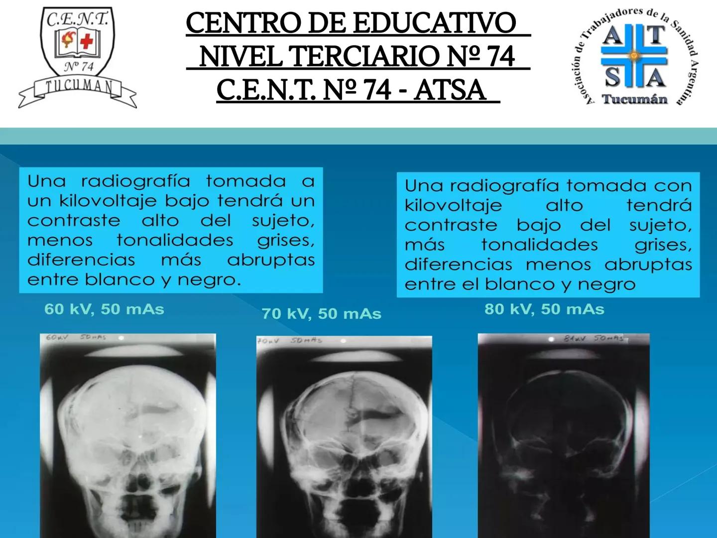 C.E.N.T.
+
N° 74
TUCUMAN
CENTRO DE EDUCATIVO
NIVEL TERCIARIO N№ 74
C.E.N.T. Nº 74 - ATSA
IMAGEN RADIOGRÁFICA
* Imagen radiografía es la