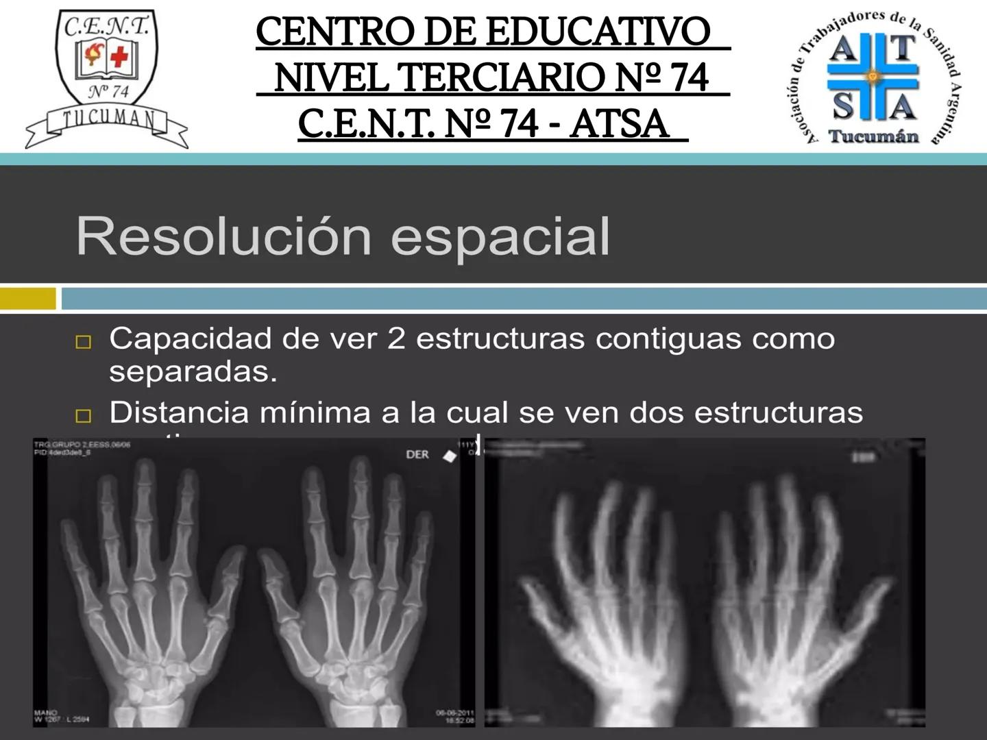 C.E.N.T.
+
N° 74
TUCUMAN
CENTRO DE EDUCATIVO
NIVEL TERCIARIO N№ 74
C.E.N.T. Nº 74 - ATSA
IMAGEN RADIOGRÁFICA
* Imagen radiografía es la