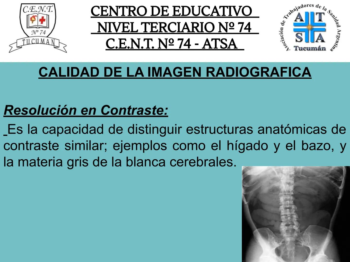 C.E.N.T.
+
N° 74
TUCUMAN
CENTRO DE EDUCATIVO
NIVEL TERCIARIO N№ 74
C.E.N.T. Nº 74 - ATSA
IMAGEN RADIOGRÁFICA
* Imagen radiografía es la