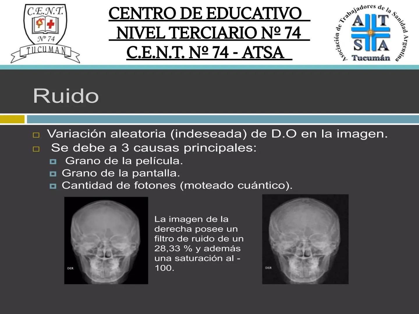 C.E.N.T.
+
N° 74
TUCUMAN
CENTRO DE EDUCATIVO
NIVEL TERCIARIO N№ 74
C.E.N.T. Nº 74 - ATSA
IMAGEN RADIOGRÁFICA
* Imagen radiografía es la