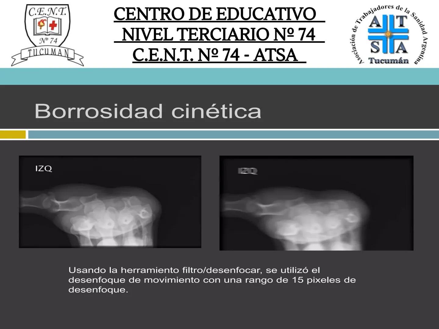 C.E.N.T.
+
N° 74
TUCUMAN
CENTRO DE EDUCATIVO
NIVEL TERCIARIO N№ 74
C.E.N.T. Nº 74 - ATSA
IMAGEN RADIOGRÁFICA
* Imagen radiografía es la