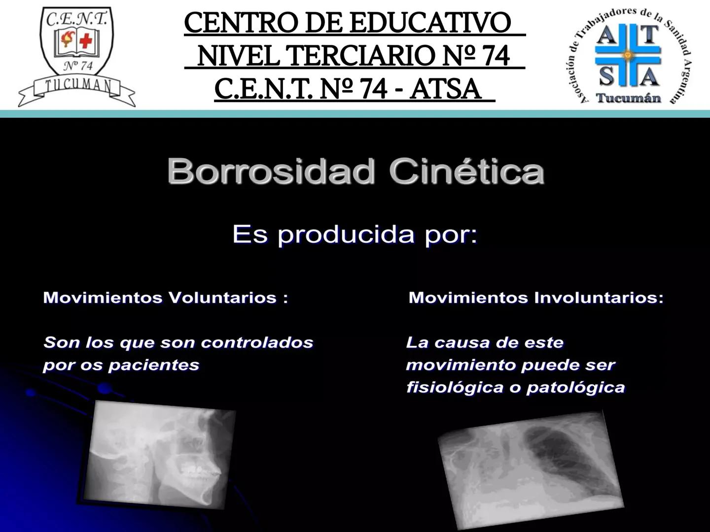 C.E.N.T.
+
N° 74
TUCUMAN
CENTRO DE EDUCATIVO
NIVEL TERCIARIO N№ 74
C.E.N.T. Nº 74 - ATSA
IMAGEN RADIOGRÁFICA
* Imagen radiografía es la