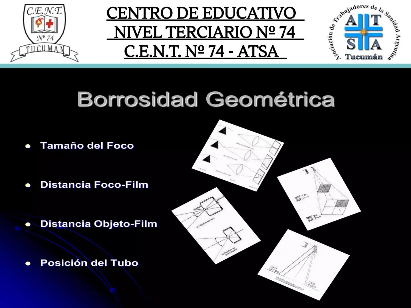 C.E.N.T.
+
N° 74
TUCUMAN
CENTRO DE EDUCATIVO
NIVEL TERCIARIO N№ 74
C.E.N.T. Nº 74 - ATSA
IMAGEN RADIOGRÁFICA
* Imagen radiografía es la