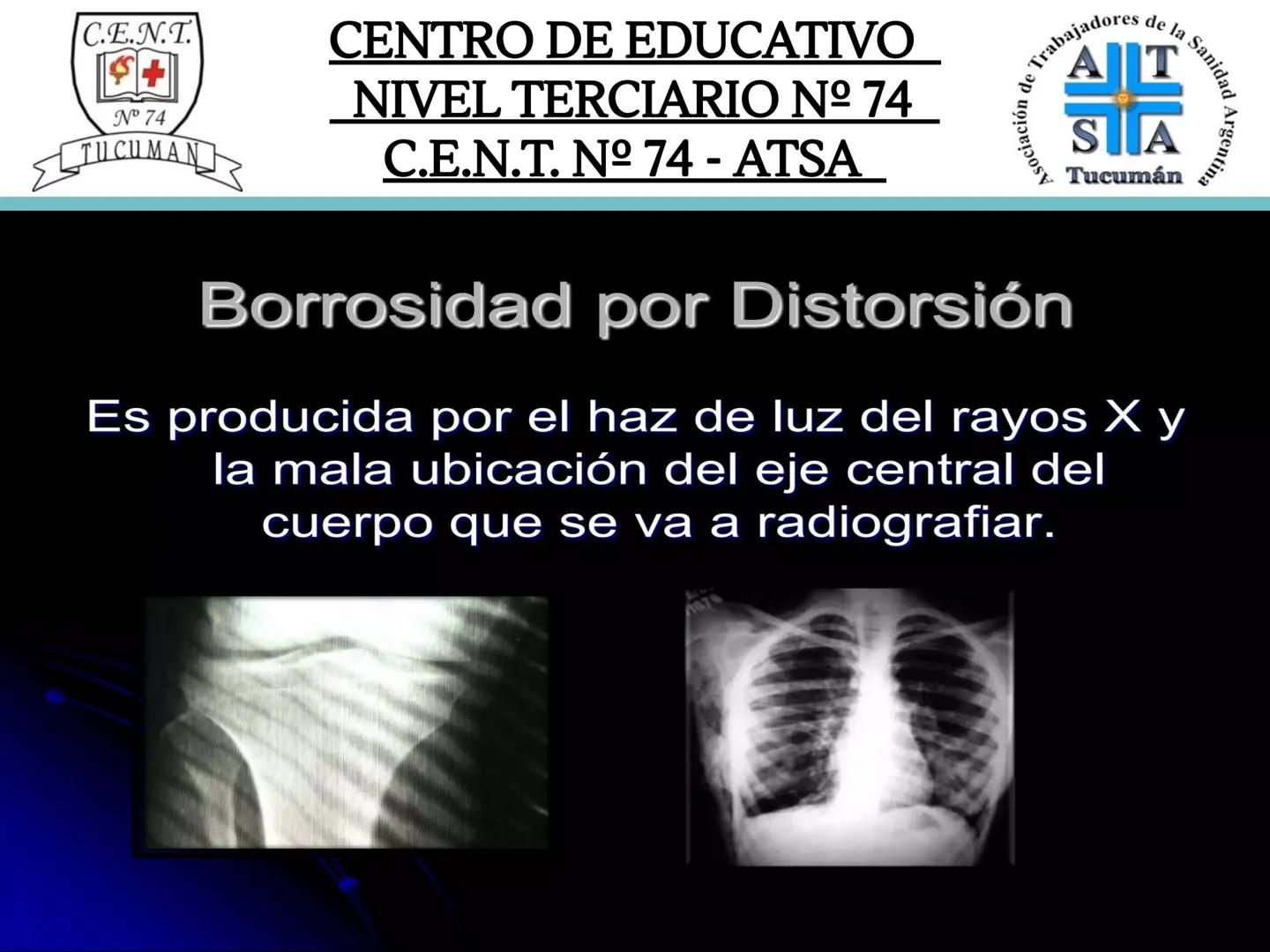 C.E.N.T.
+
N° 74
TUCUMAN
CENTRO DE EDUCATIVO
NIVEL TERCIARIO N№ 74
C.E.N.T. Nº 74 - ATSA
IMAGEN RADIOGRÁFICA
* Imagen radiografía es la