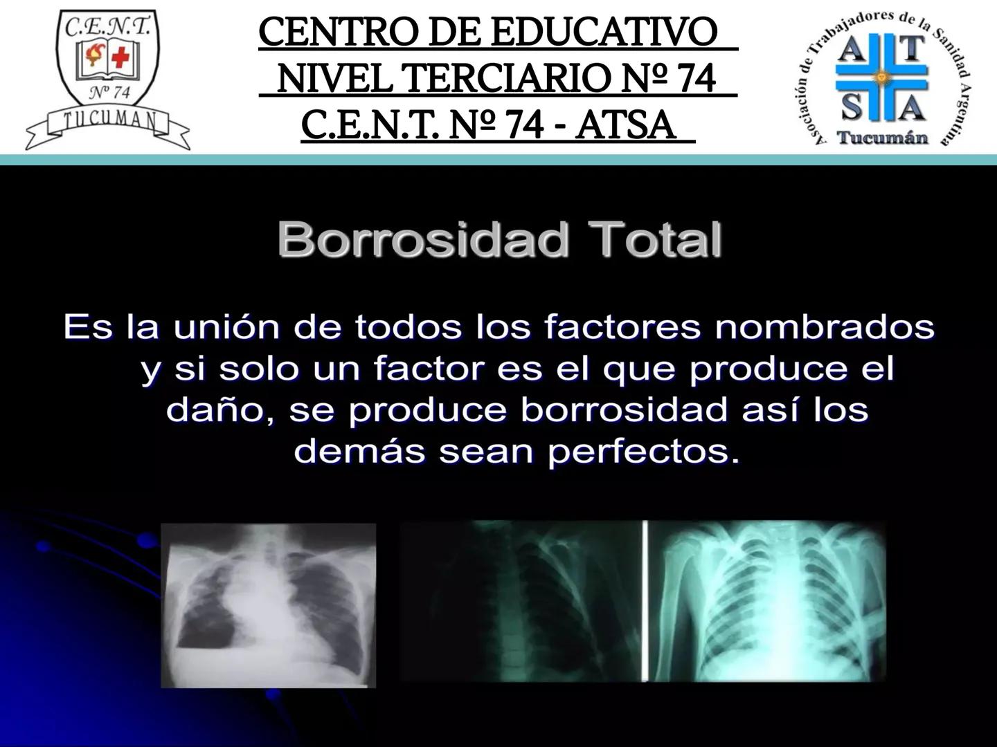 C.E.N.T.
+
N° 74
TUCUMAN
CENTRO DE EDUCATIVO
NIVEL TERCIARIO N№ 74
C.E.N.T. Nº 74 - ATSA
IMAGEN RADIOGRÁFICA
* Imagen radiografía es la