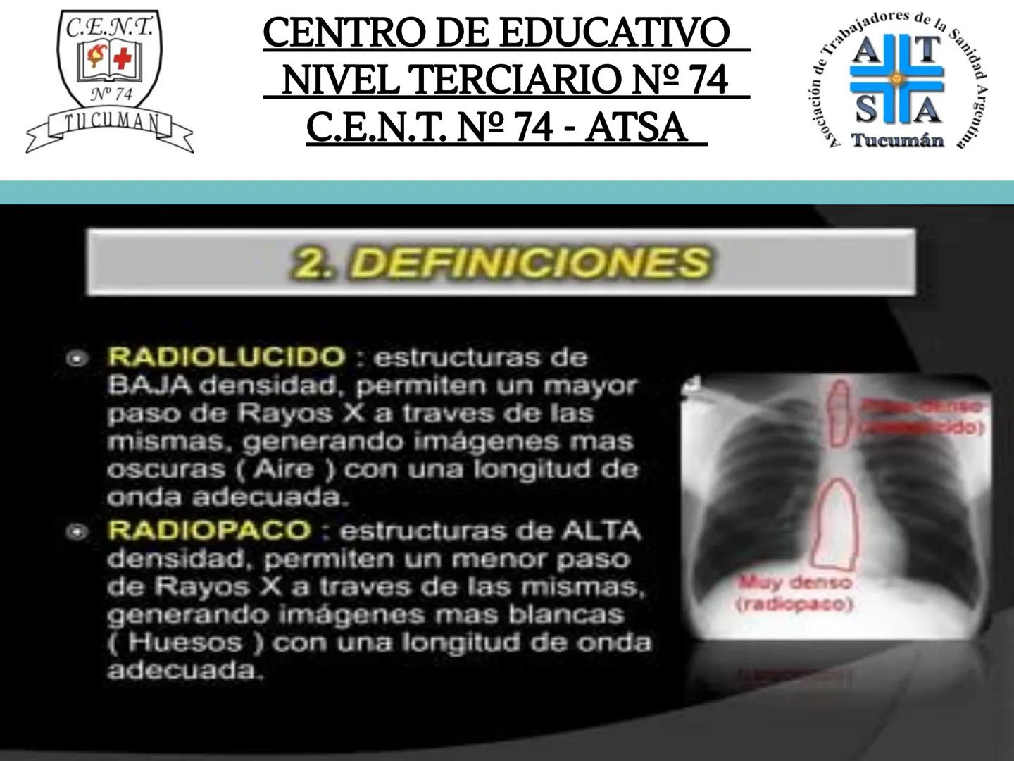 C.E.N.T.
+
N° 74
TUCUMAN
CENTRO DE EDUCATIVO
NIVEL TERCIARIO N№ 74
C.E.N.T. Nº 74 - ATSA
IMAGEN RADIOGRÁFICA
* Imagen radiografía es la