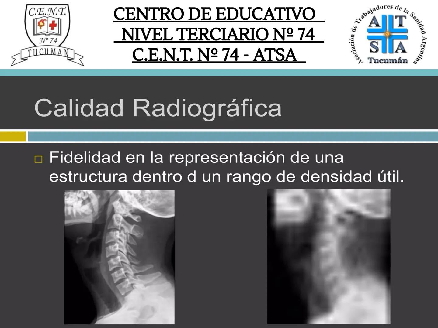 C.E.N.T.
+
N° 74
TUCUMAN
CENTRO DE EDUCATIVO
NIVEL TERCIARIO N№ 74
C.E.N.T. Nº 74 - ATSA
IMAGEN RADIOGRÁFICA
* Imagen radiografía es la