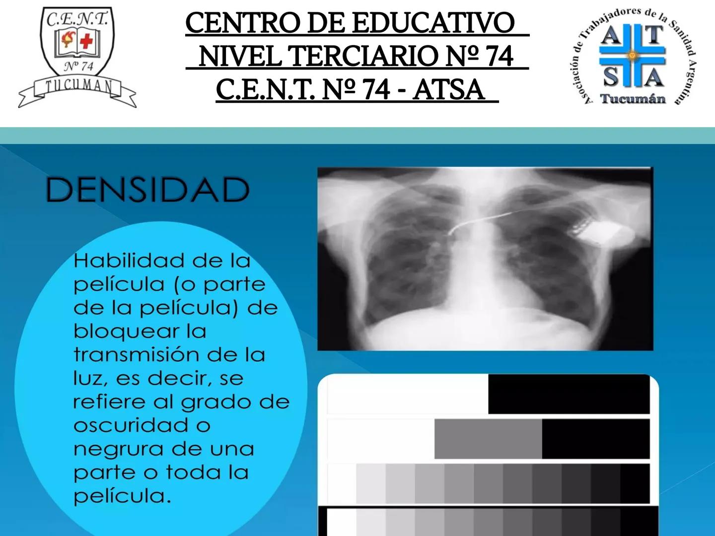 C.E.N.T.
+
N° 74
TUCUMAN
CENTRO DE EDUCATIVO
NIVEL TERCIARIO N№ 74
C.E.N.T. Nº 74 - ATSA
IMAGEN RADIOGRÁFICA
* Imagen radiografía es la