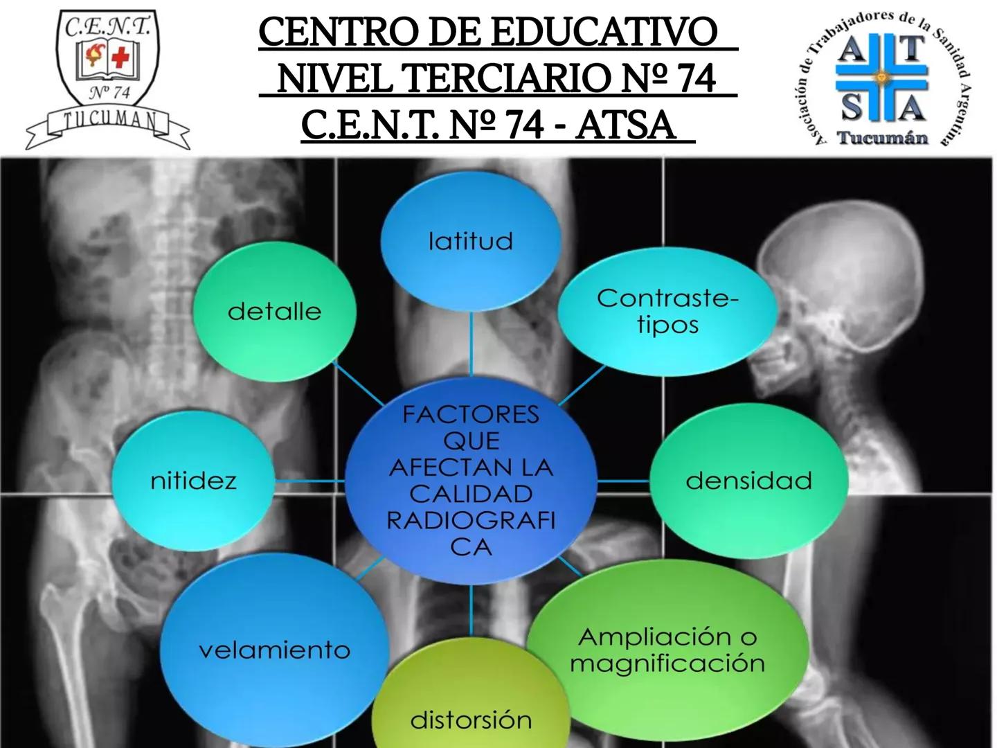 C.E.N.T.
+
N° 74
TUCUMAN
CENTRO DE EDUCATIVO
NIVEL TERCIARIO N№ 74
C.E.N.T. Nº 74 - ATSA
IMAGEN RADIOGRÁFICA
* Imagen radiografía es la
