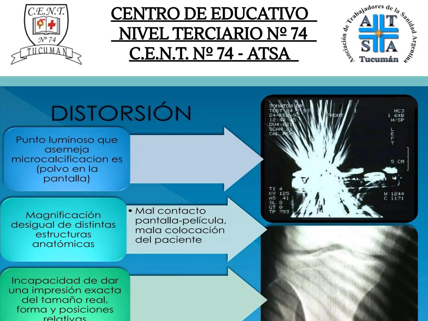 C.E.N.T.
+
N° 74
TUCUMAN
CENTRO DE EDUCATIVO
NIVEL TERCIARIO N№ 74
C.E.N.T. Nº 74 - ATSA
IMAGEN RADIOGRÁFICA
* Imagen radiografía es la