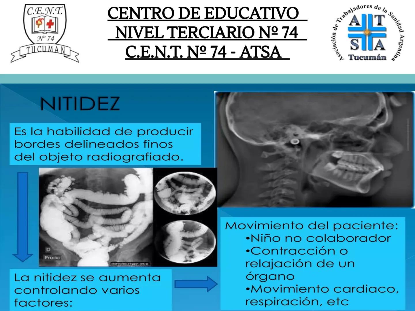 C.E.N.T.
+
N° 74
TUCUMAN
CENTRO DE EDUCATIVO
NIVEL TERCIARIO N№ 74
C.E.N.T. Nº 74 - ATSA
IMAGEN RADIOGRÁFICA
* Imagen radiografía es la